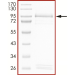 EGFR (C797S L858R), Active